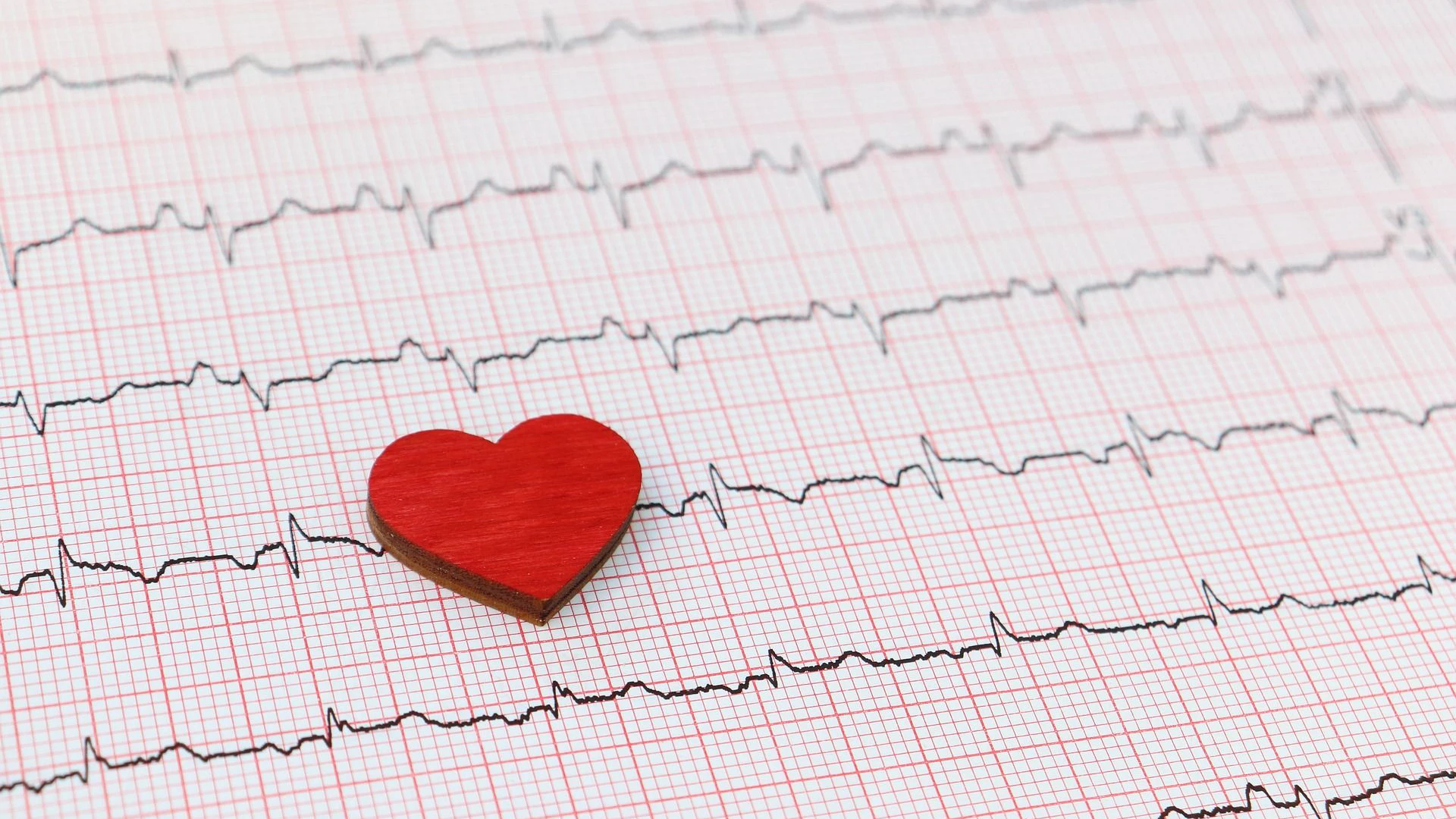 EKG