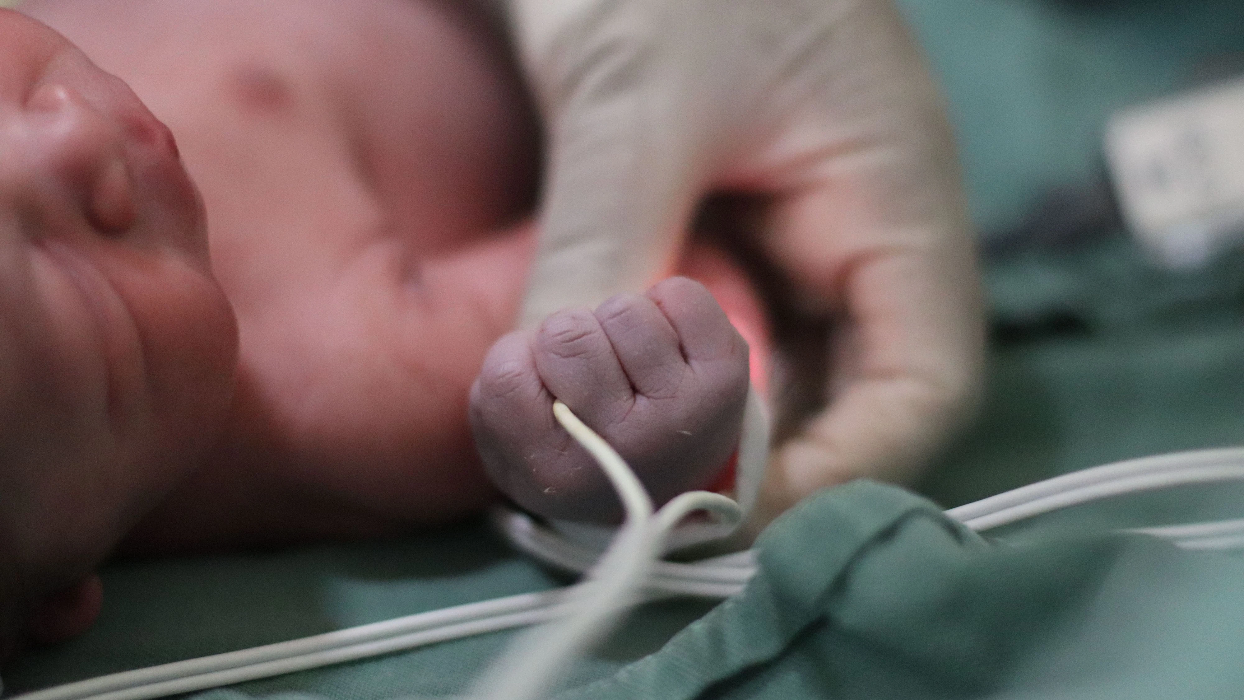 Baby Neugeborenes Nabelschnur