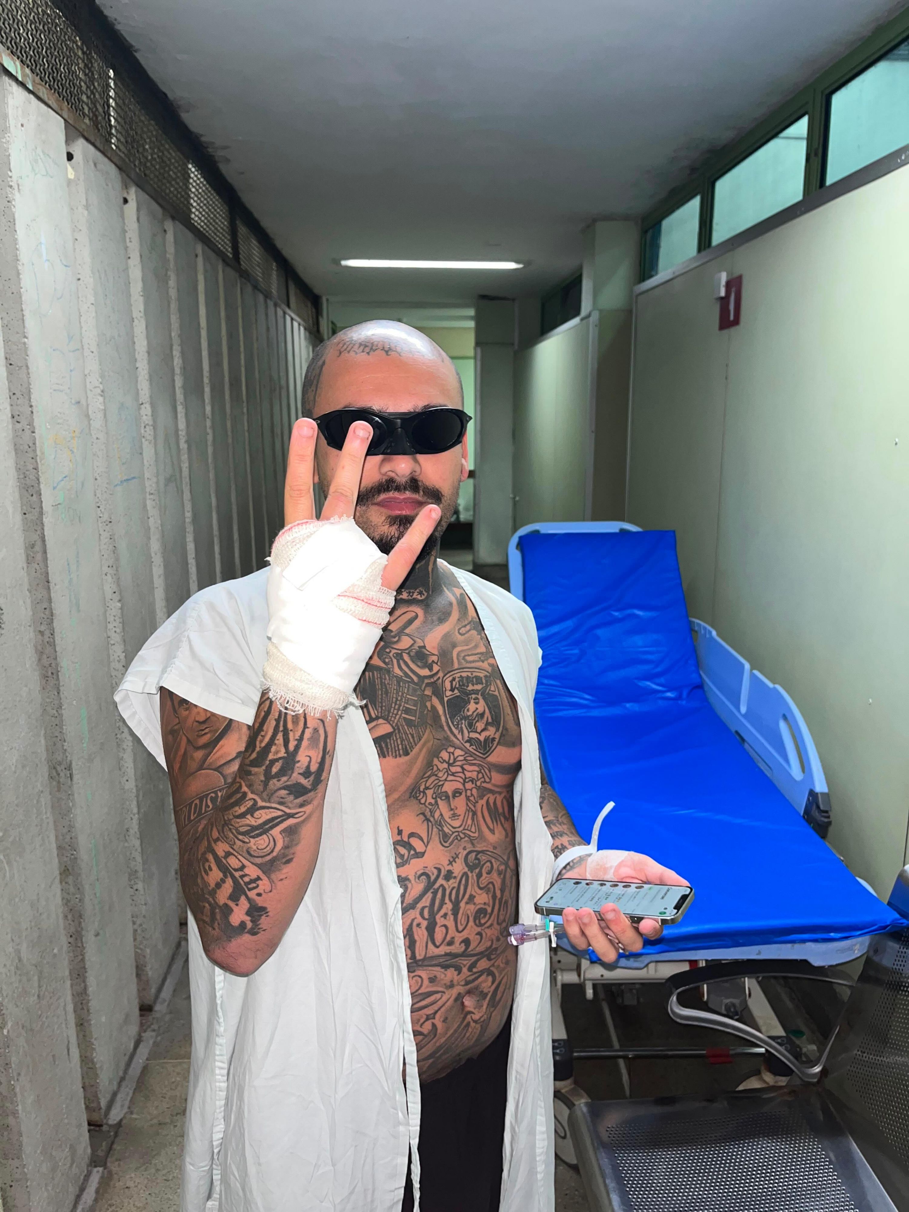 Streamer Lodk7777 (bürgerlich Adalton Rodrigues) verlor wegen eines unnötigen Stunts seinen rechten Ringfinger.