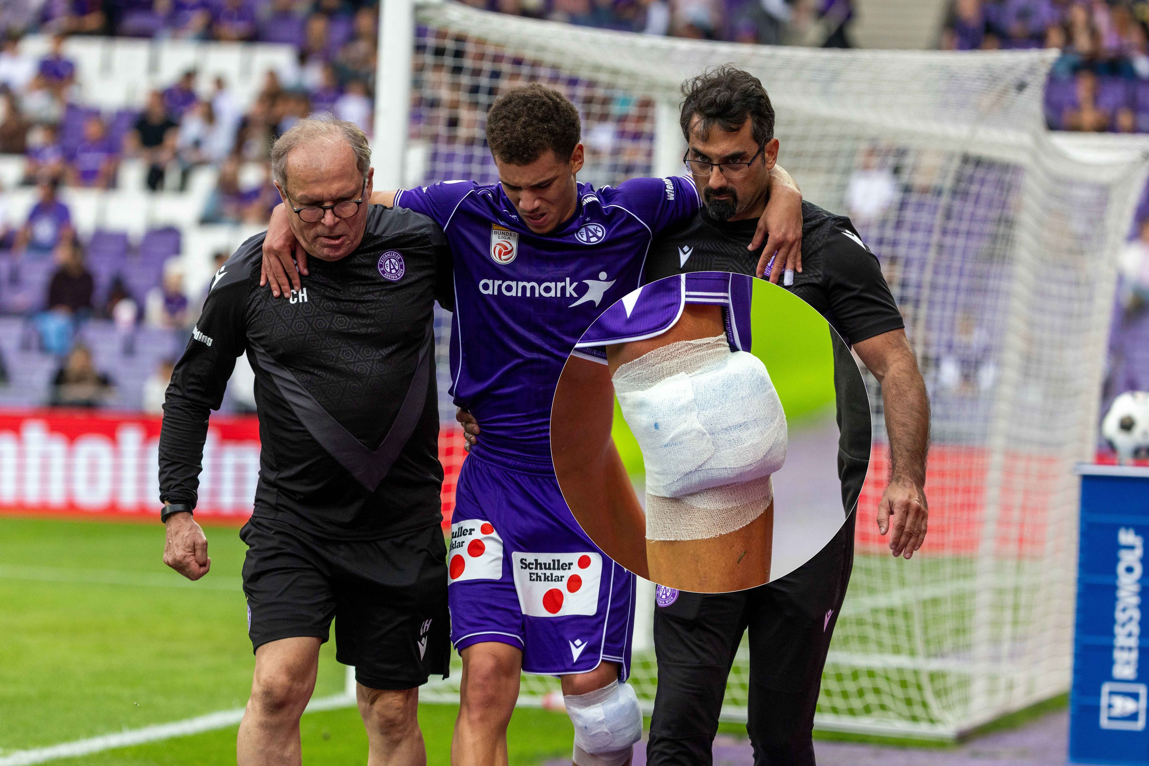 Daniel Nnodim mit dick eingebundenem Knie