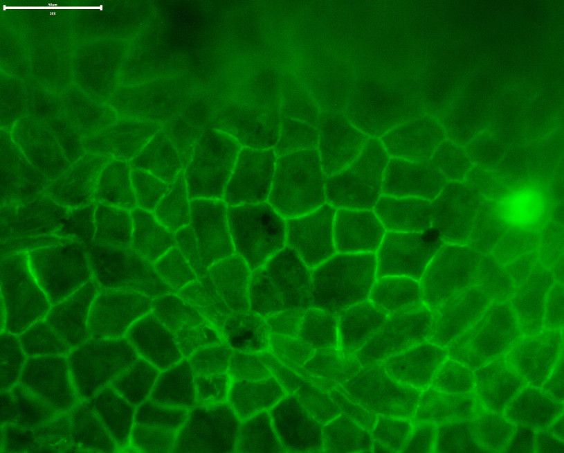 Die Autoren verglichen die Kutikula-Struktur moderner Blätter (oben unter dem Epifluoreszenzmikroskop abgebildet) mit fossilen Blattkutikula, um ein Modell für die Kronendachbedeckung zu erstellen. Der Maßstab beträgt 50 Mikrometer (0,05 mm).