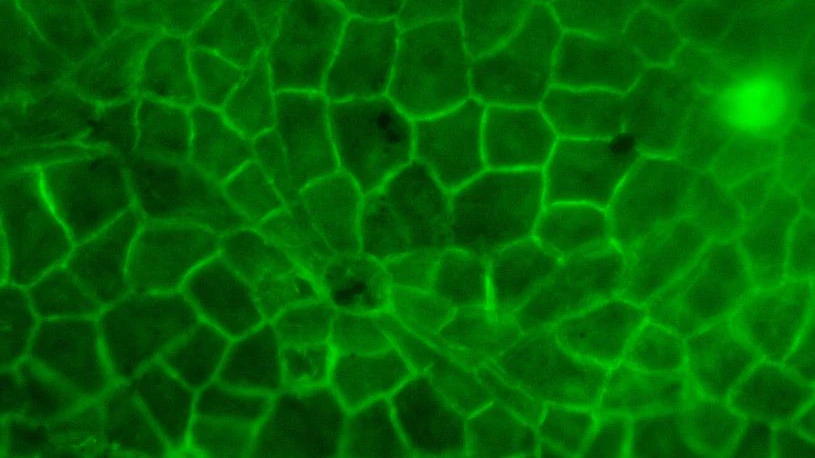 Die Autoren verglichen die Kutikula-Struktur moderner Blätter (oben unter dem Epifluoreszenzmikroskop abgebildet) mit fossilen Blattkutikula, um ein Modell für die Kronendachbedeckung zu erstellen. Der Maßstab beträgt 50 Mikrometer (0,05 mm).