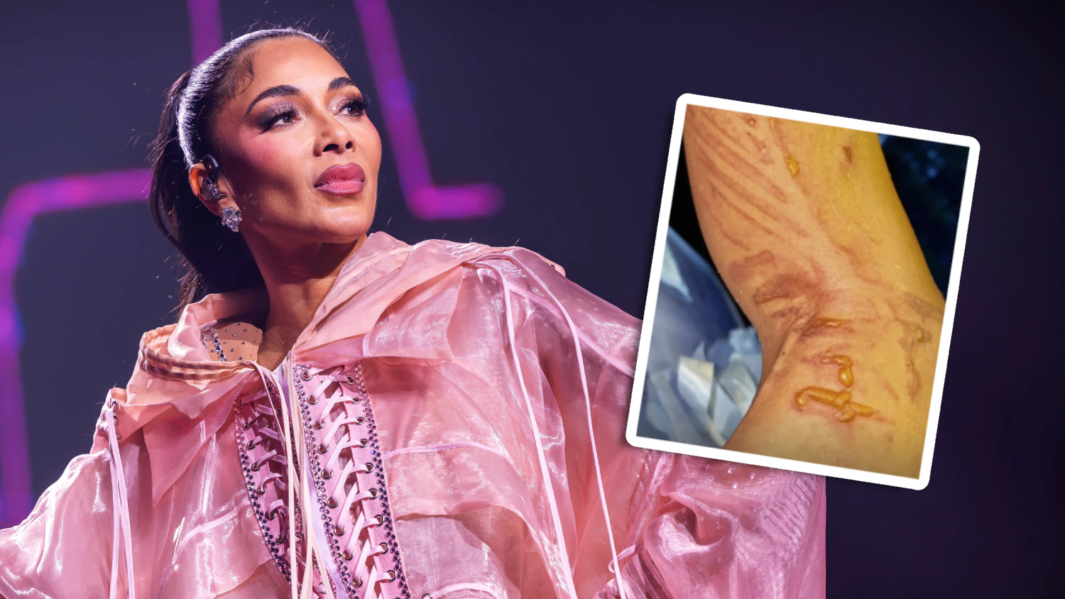 Heftige Verletzung! Scherzinger zieht Auftritt trotzdem durch