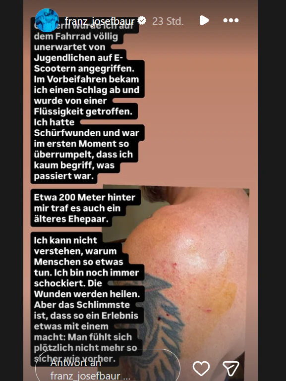 Franz Josef Baur zeigt die vielen, kleinen Schnittwunden an seiner Schulter und schildert den Vorfall