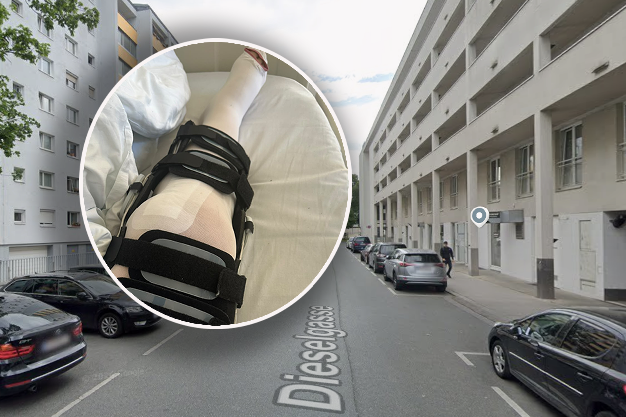 Die 56-Jährige wurde in Favoriten am Gehsteig von einem E-Scooter erfasst.