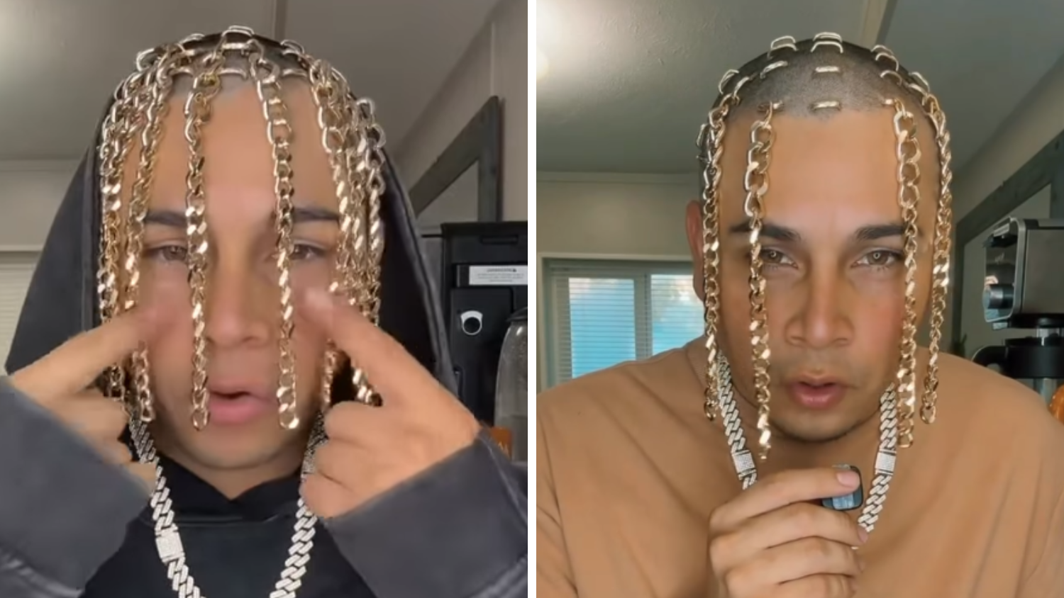 Rapper Dan Sur tauscht Haare gegen Goldzottel
