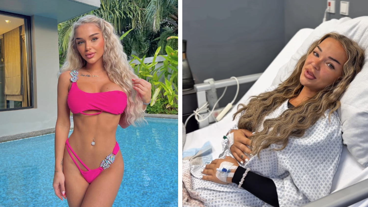 Kaum Fett – trotzdem OP! Emmy Russ legt sich unters Messer