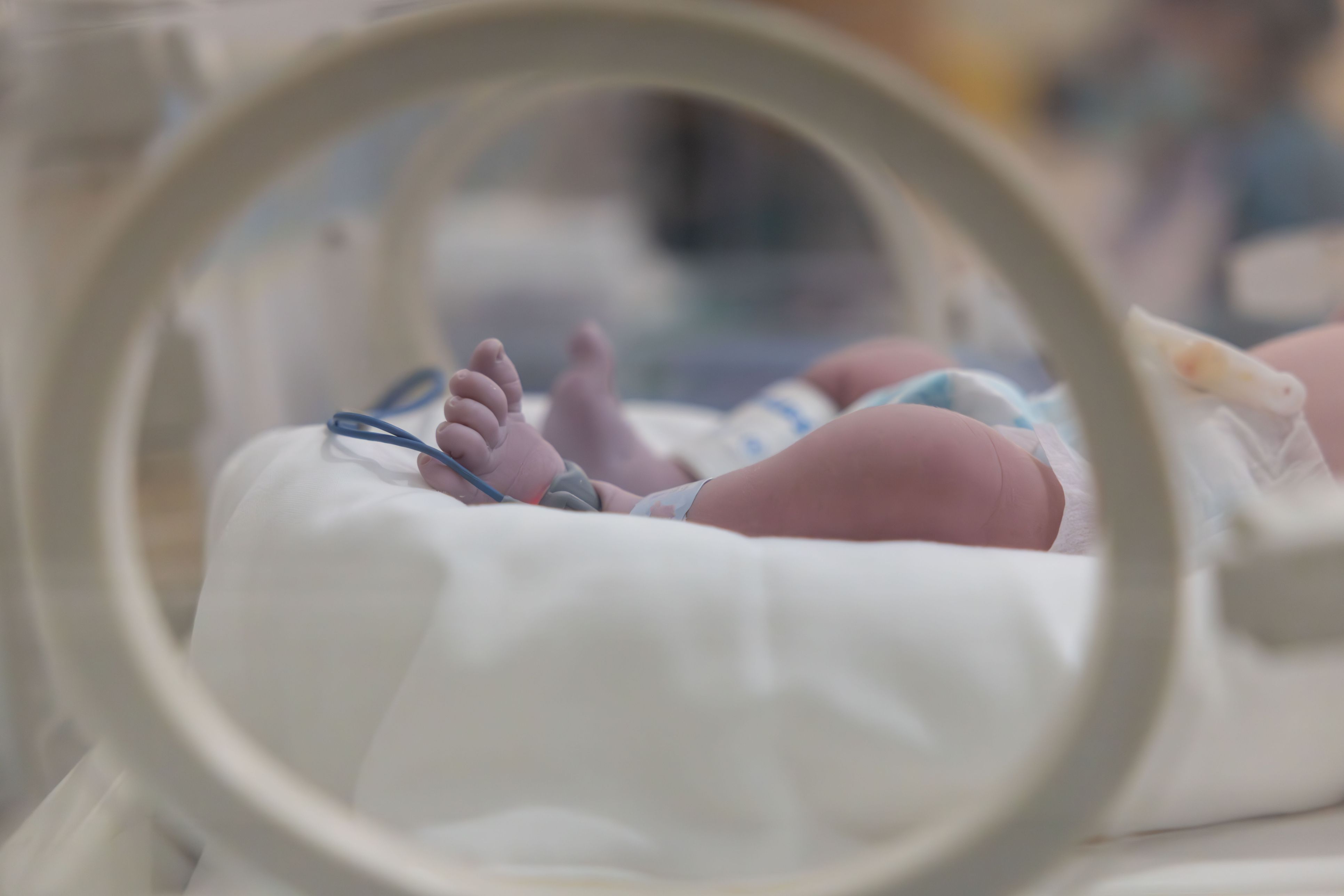 Das kleine Baby kam mit nur 520 Gramm zur Welt (Symbolbild).