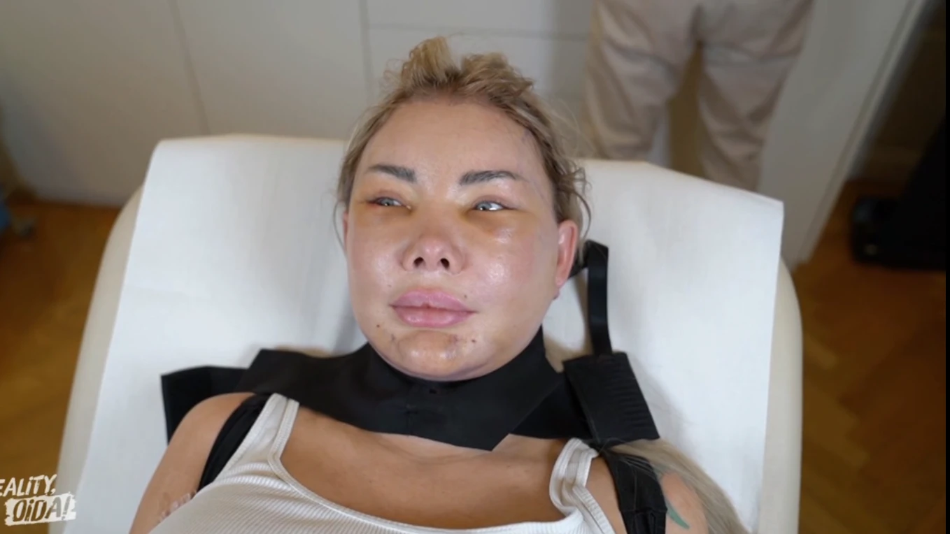 Sabrina Wlk nach der OP