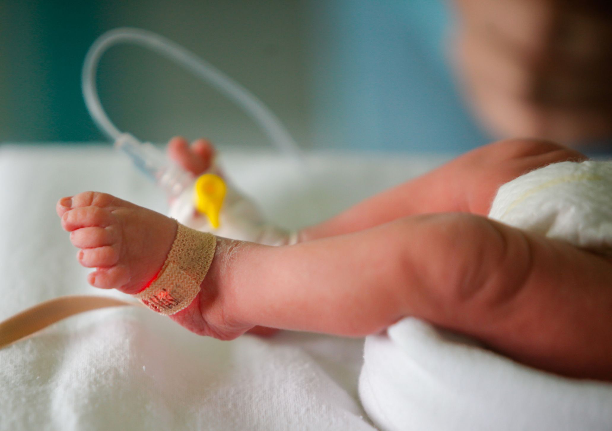 Das Baby erlitt bei dem Vorfall einen Schädelbruch – nun wurde der Arzt verurteilt.