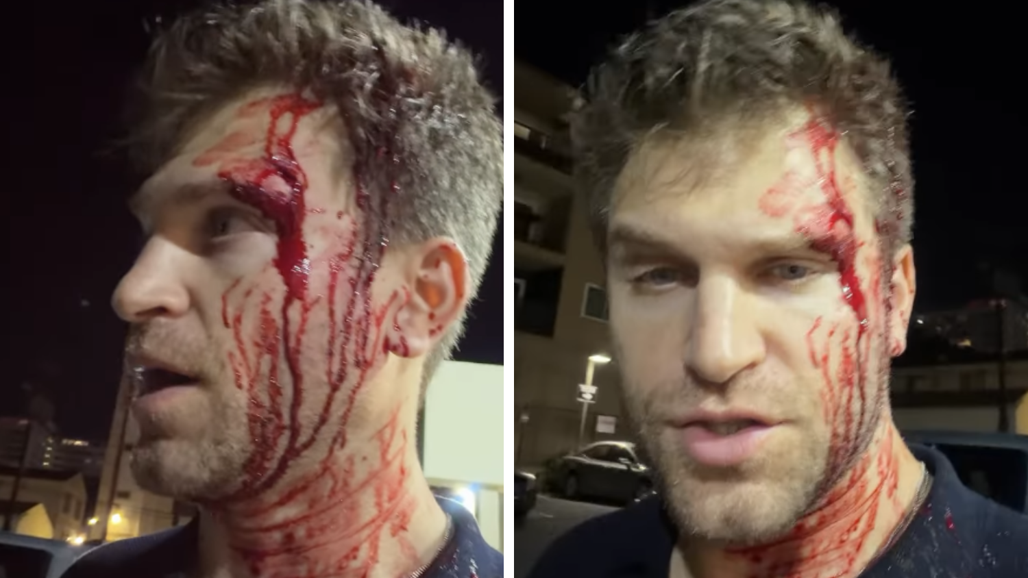 „Pretty Little Liars“-Star beim Einkaufen brutal überfallen