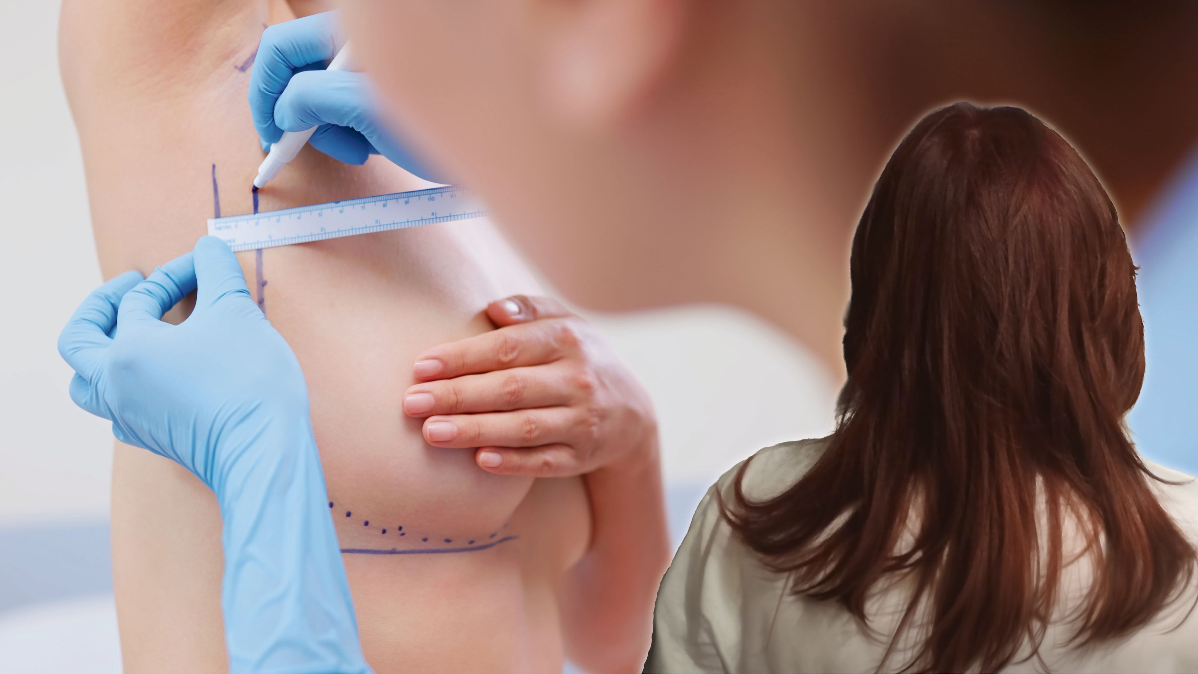 Die Betroffene bereut ihre OP, will andere Frauen vor vorschnellen Entscheidungen bewahren.