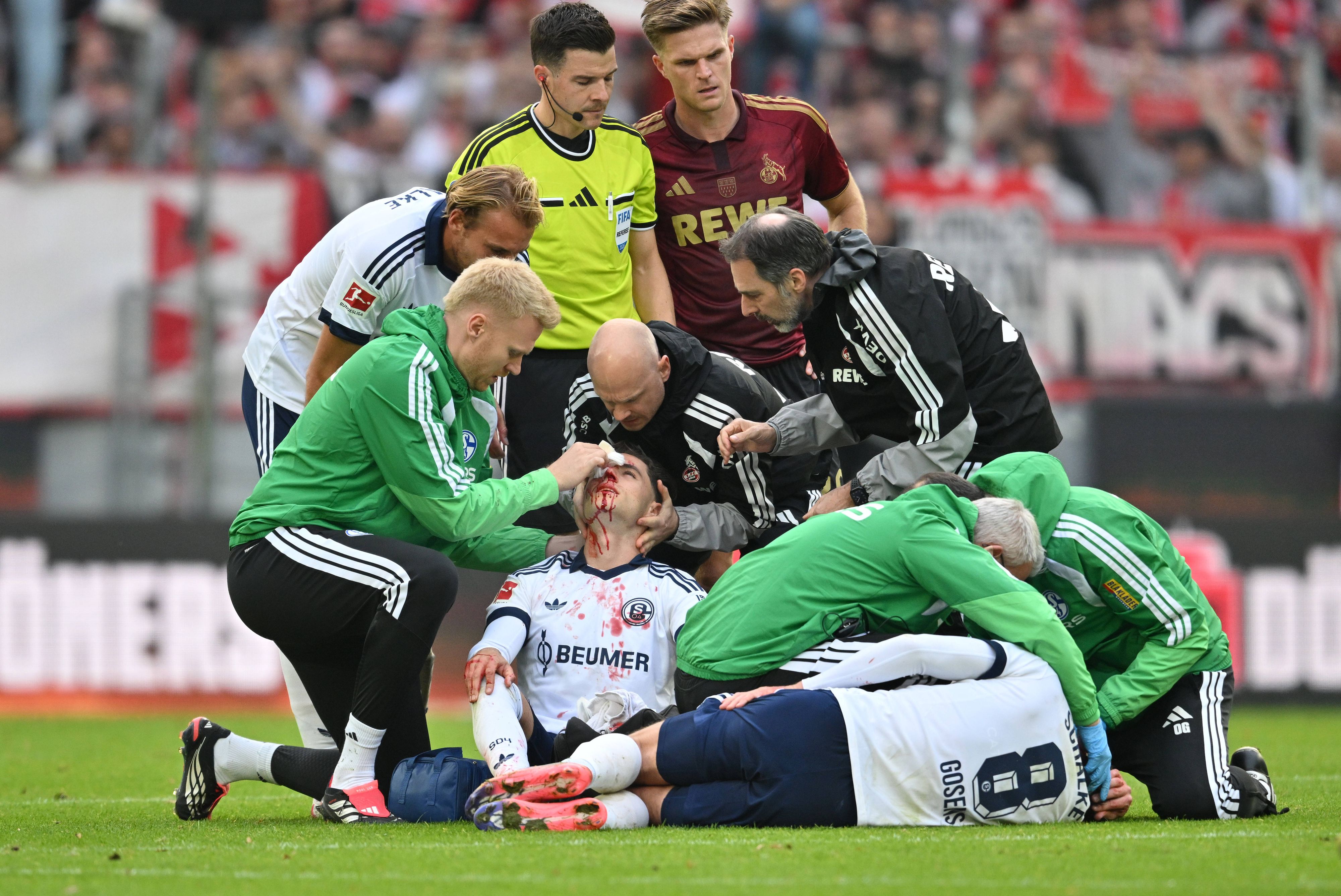 Zwei Schalker mussten behandelt werden und verletzt raus.