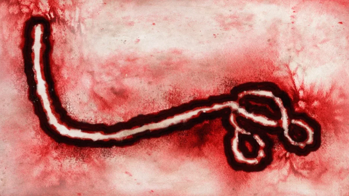 Großaufnahme des Bundibugyo-Ebolavirus, das für den Ausbruchs in der DR Kongo 2026 verantwortlich ist.